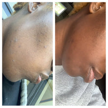 Load image into Gallery viewer, It's The CLEAR SKIN For Me 🔍